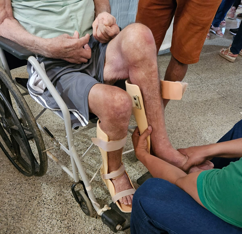 Sesapi entrega 1610 órteses e próteses na região da Serra da Capivara