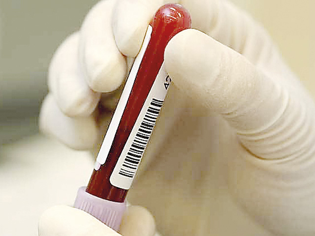 Exame descarta dengue hemorrágica em idosa que morreu no HRJL