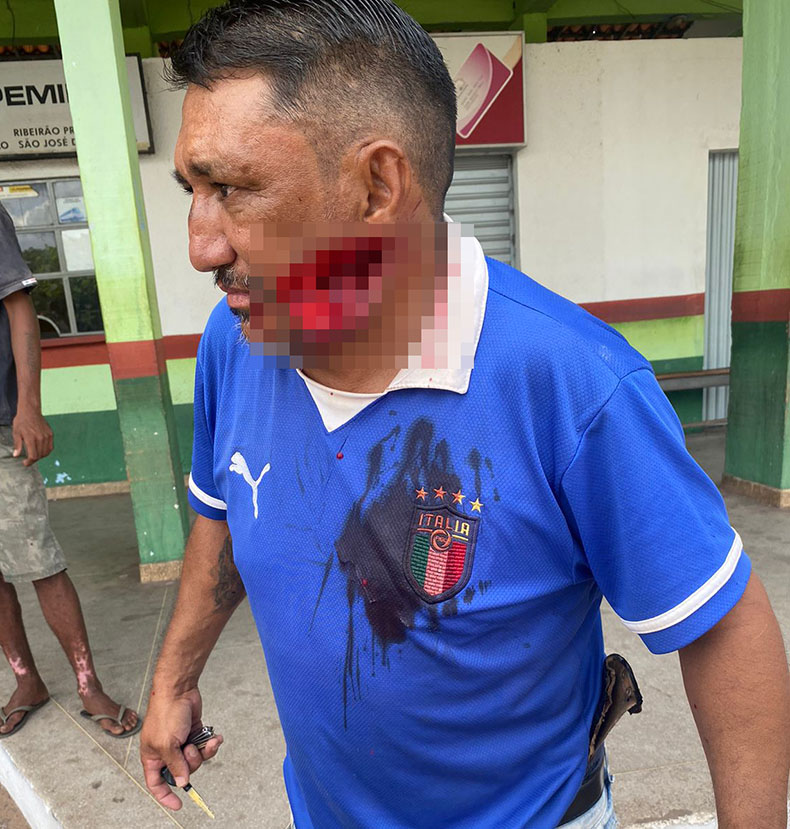 Homem que teve parte da face arrancada com facão morre em Hospital de Picos