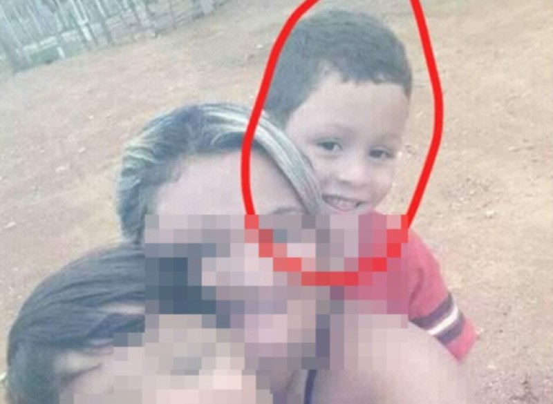 Criança de 9 anos morre após ser atingida com tiro na cabeça em Fronteira (PI)